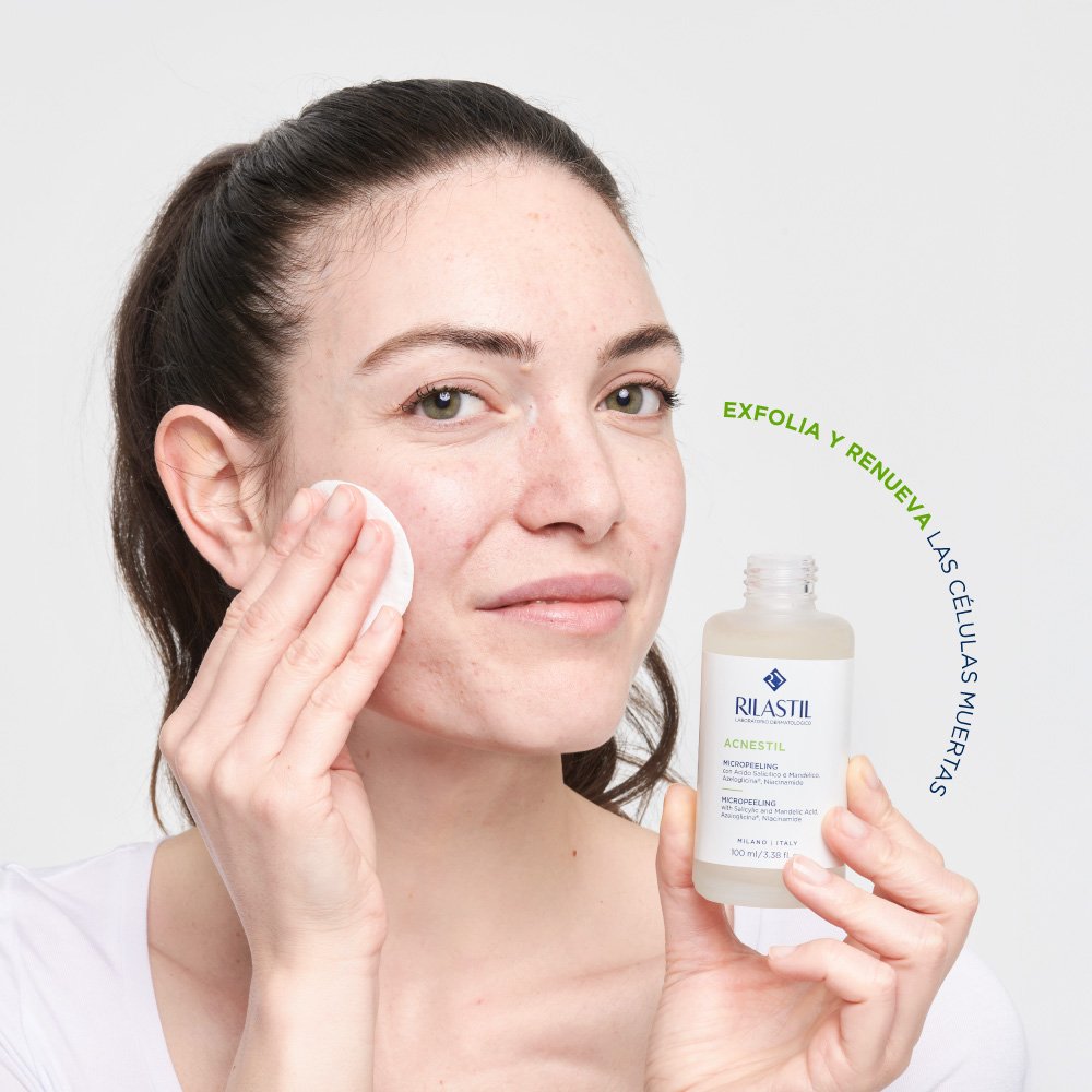 ACNESTIL_Micropeeling_4
